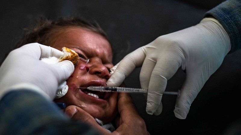 Fotografija: Zdravnik daje sirskemu otroku injekcijo z zdravilom za kožno bolezen leišmaniozo v zdravstvenem centru v Karami na severu Sirije. Stotine ljudi v severni sirski provinci trpi zaradi porasta kožne bolezni, ki jo povzroča mikroskopski parazit. Le ta se prenaša s peščenimi muhami. Bolezen, ki povzroča razjede in brazgotine, je običajno povezana z revščino, slabimi sanitarijami in podhranjenostjo. Foto Delil Souleiman Afp