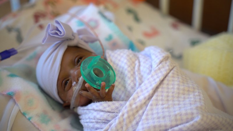 Fotografija: Saybie je lanskega decembra na svet privekala mnogo prezgodaj, v 6. mesecu nosečnosti. FOTO: AFP
