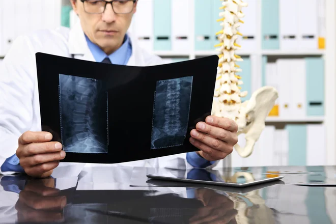 73007180 - radiologist doctor checking xray, healthcare, medical and radiology concept.