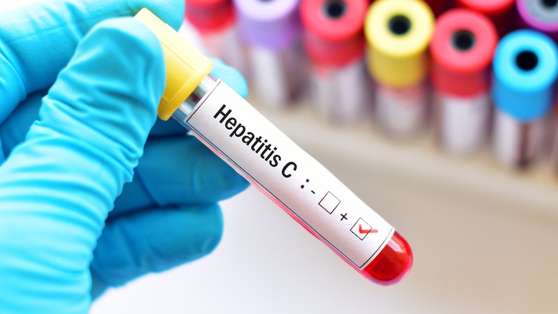 Fotografija: WHO je prvo globalno strategijo obvladovanja hepatitisa C sprejela s ciljem, da ga do leta 2030 odpravi kot javnozdravstveni problem FOTO: Shutterstock