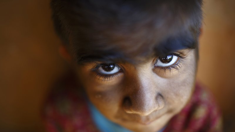 Fotografija: Otrok s hipertrihozo. FOTO: Navesh Citrakar/Reuters