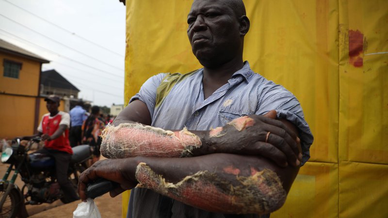 Fotografija: Žrtev plinske eksplozije stoji na kraju nesreče v Lagosu. V okrožju Iju-Ishaga v Lagosu je eksplodirala cisterna, ki je prevažala bencin, pri čemer je bilo več kot ducat oseb težje ranjenih, več zgradb in vozil pa uničenih. V eksploziji plina je umrla ena oseba. FOTO: Kola Sulaimon/Afp