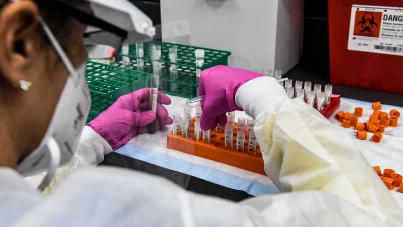Fotografija: Do zdaj sta prve zelo spodbudne izsledke o cepivih predstavila Moderna in Biontech s Pfizerjem. FOTO: Chandan Khanna/AFP
