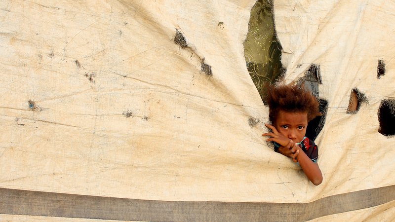 Fotografija: Več kot dva milijona jemenskih otrok, največjih žrtev vojne, je po podatkih Unicefa akutno podhranjenih. FOTO: Essa Ahmed/AFP