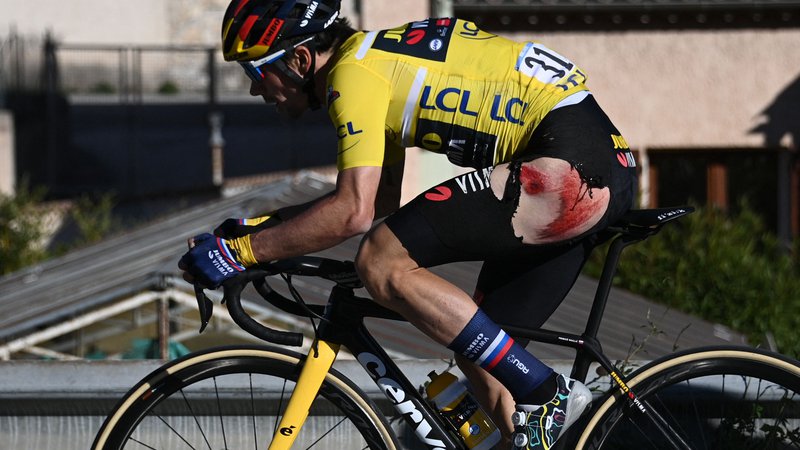 Fotografija: Primož Roglič se je poškodoval v zaključni etapi dirke Pariz–Nica. FOTO: Anne-christine Poujoulat/AFP
