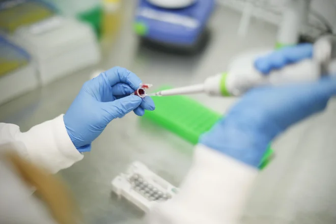 Države članice EU kupujejo večinoma enako medicinsko opremo in zdravila. FOTO:&nbsp;Hočevar Uroš/Delo
