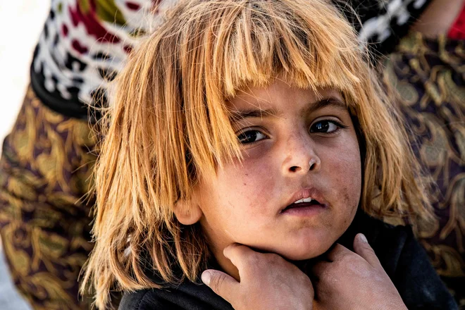 Portret sirskega otroka, ki je s starši zaradi vojne pobegnil iz Ras al-Aine, obmejnega mesta, ki ga nadzirajo Turčija in njeni sirski pooblaščenci. FOTO: Delil Souleiman/Afp<br />
<br />
