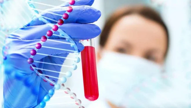 Fotografija: Laboratorijski izvidi krvi so izjemno koristna preiskava, če imamo znanje za njihovo interpretacijo. FOTO: Shutterstock