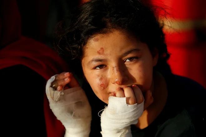 Libijska deklica, ki je v požaru na čolnu polnem migrantov utrpela opekline, sedi na nemški nevladni reševalni ladji Sea-Watch 3, ob obali italijanskega otoka Lampedusa v zahodnem Sredozemskem morju. FOTO: Darrin Zammit Lupi/Reuters<br />
