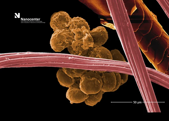 SEM-slika iztrebkov pršice. Vsaka pršica izloči do 20 iztrebkov na dan. FOTO: Bojan Ambrožič/Nanocenter