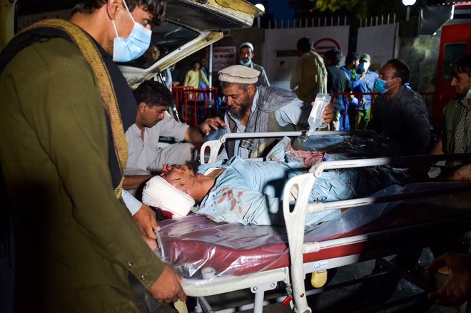 Ranjence so prepeljali v bolnišnico. FOTO: Wakil Kohsar/AFP