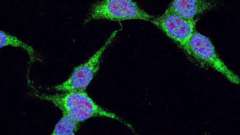 Fotografija: Diferencirane človeške nevroblastoma celice SH-SY5Y, ki izražajo bolezenske dipeptidne ponovitve gena C9orf72. Zeleno so obarvane dipeptidne ponovitve. Modro in rdeče so obarvana jedra celic. Avtor: Janja Božič