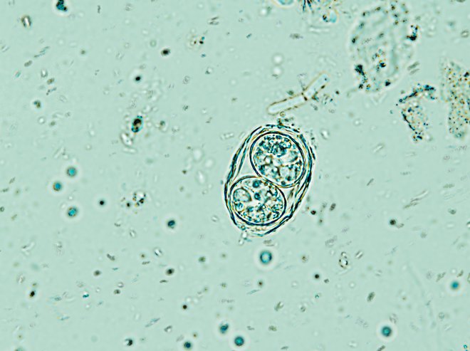Mikroskopska fotografija izolirane oociste toksoplazme FOTO: Todorean-Gabriel/Shutterstock
