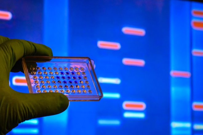 Bio-Rad ponuja 10.000 izdelkov za raziskovalno dejavnost in za klinično diagnostiko. FOTO: Shutterstock
