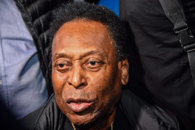 Pele je moral znova v bolnišnico Albert Einstein v São Paulu. FOTO: Nelson Almeida/AFP
