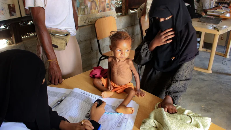 Fotografija: V Jemnu vlada epidemija lakote. FOTO: Esa Ahmed/AFP