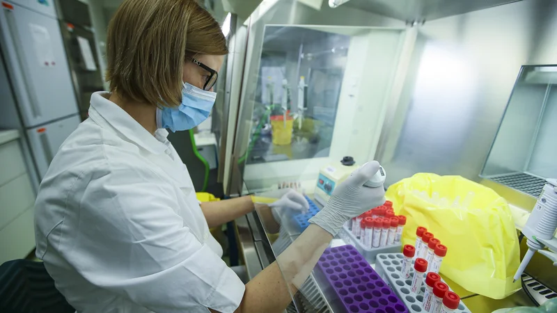 Fotografija: Inštitut za mikrobiologijo. FOTO: Jože Suhadolnik/Delo