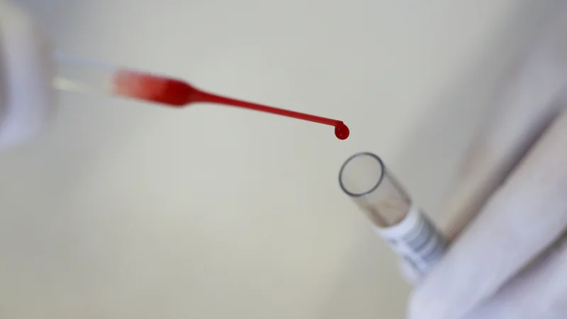 Fotografija: Hematološki bolnik, posebno tisti, ki zboli zaradi rakavih bolezni krvi, je eden najtežjih bolnikov v medicini. FOTO: Michaela Rehle/Reuters