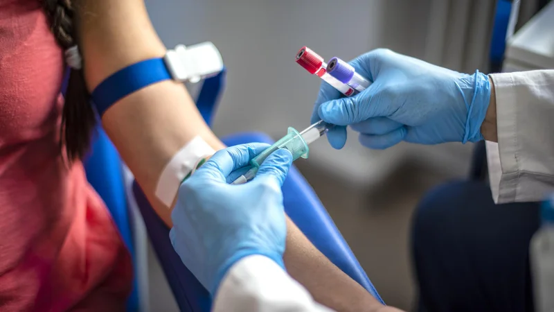 Fotografija: HDL holesterol je znan kot dober holesterol. FOTO: Shutterstock
