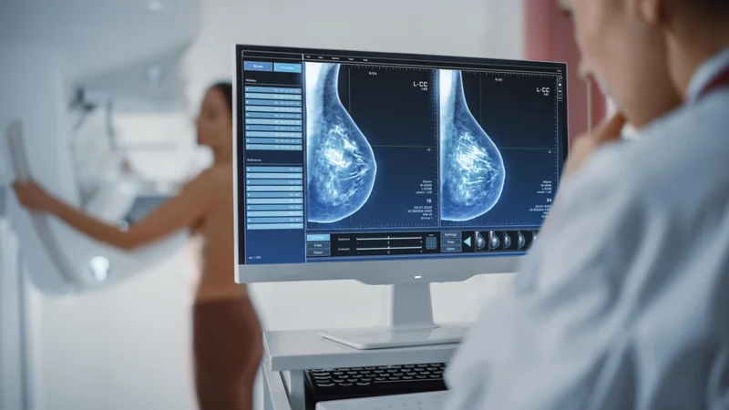 Fotografija: Strokovnjaki svetujejo, da bi s presejalnimi pregledi z mamografijo morali začeti že pri ženska v srednjih in poznih 40. letih. FOTO: Shutterstock