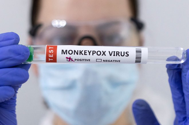 Virus opičjih koz, član rodu ortopoksvirusov v družini poksvirusov, ki je podoben virusu črnih koz. FOTO: Dado Ruvic/Reuters
