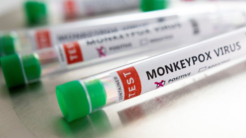 Fotografija: V Sloveniji so potrdili prvi primer okužbe z opičjimi kozami. FOTO: Dado Ruvic/Reuters
