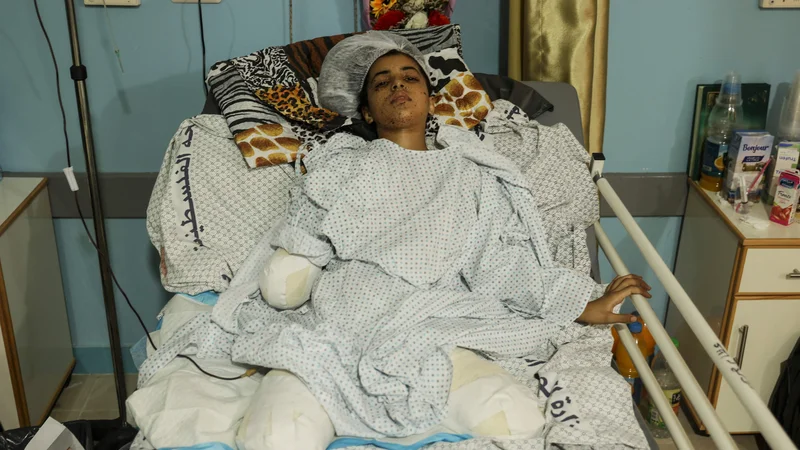 Fotografija: 11-letna palestinska deklica Rahaf Salman, ki je v zadnjem spopadu med Izraelom in palestinskimi borci izgubila okončine, je na zdravljenju v bolnišnici v begunskem taborišču Džabalija na severu Gaze. Foto: Mahmud Hams/Afp