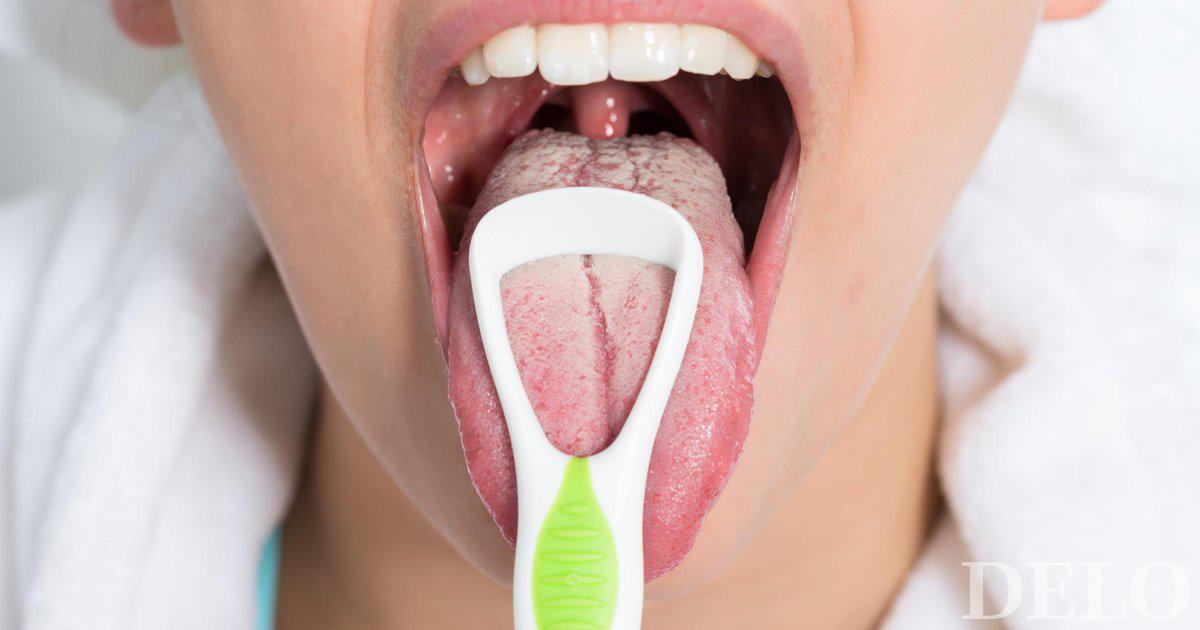 Gesundheitssymptome, die sich in deiner Zunge verstecken