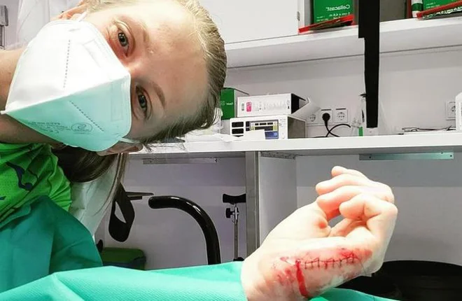 Njena rana je vse prej kot nedolžna. FOTO: Instagram
