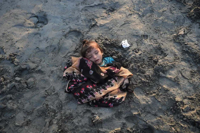 Deklica spi na plaži v Karačiju, po tem, ko so jo starši zakopali v pesek, saj verjamejo, da bo izpostavljenost sončnemu mrku ozdravila njeno bolezen. Foto: Asif Hassan/Afp