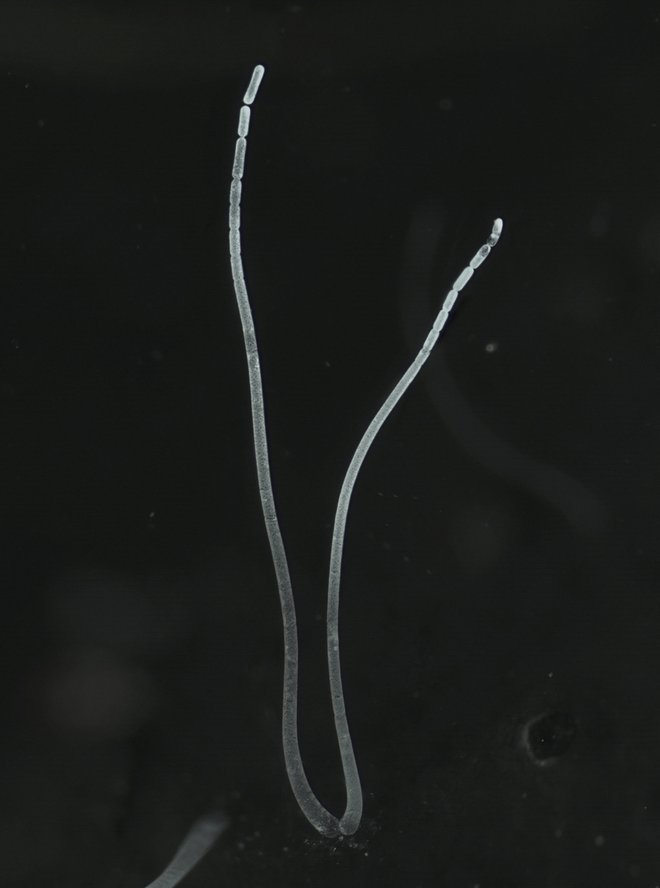 Bakterijo Thiomargarita mag­nifica so odkrili v vodi med koreninami mangrov. Foto Jean-Marie Volland/Lawrence Berk/Reuters

