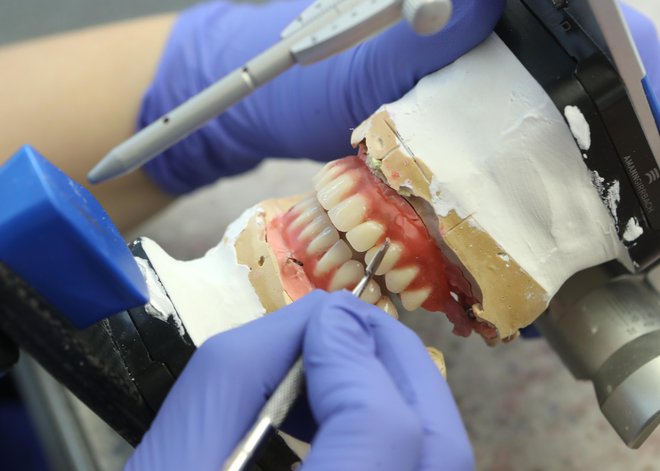 V zobozdravstvu je med vsemi zaposlenimi že več kot polovica zdravnikov v zasebni dejavnosti, podobno velja za zobne tehnike in zobne protetike. FOTO: Dejan Javornik
