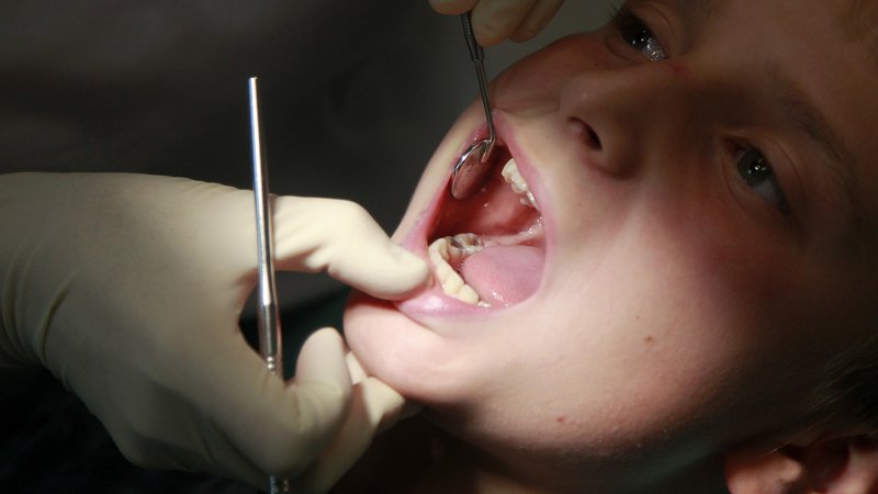Fotografija: Vzrok za dolge čakalne dobe je predvsem pomanjkanje zadostnega števila ortodontov v javni mreži glede na širok obseg pravic. Foto Leon Vidic
