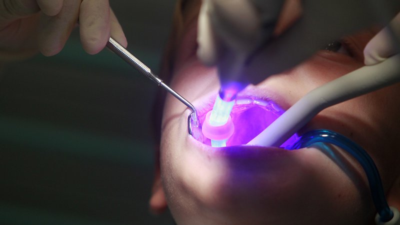 Fotografija: Lastnik izpadlega mlečnega zoba naj namesto drobiža dobil potrdilo o vplačilu v zobozdravstveni sklad. FOTO: Leon Vidic
