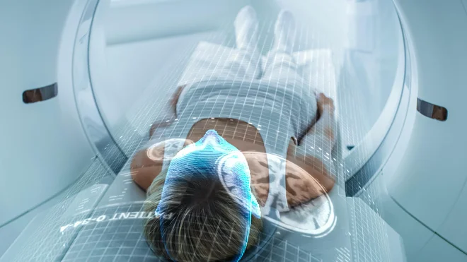 V projektu CherPET bodo razvijali novo vrsto detektorjev za pozitronsko tomografijo. FOTO: Shutterstock

 