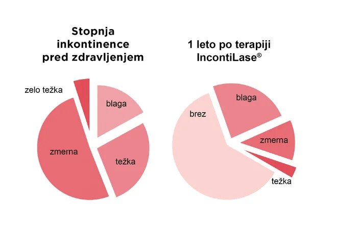 Visoka stopnja uspešnosti zdravljenja. Foto: Fotona