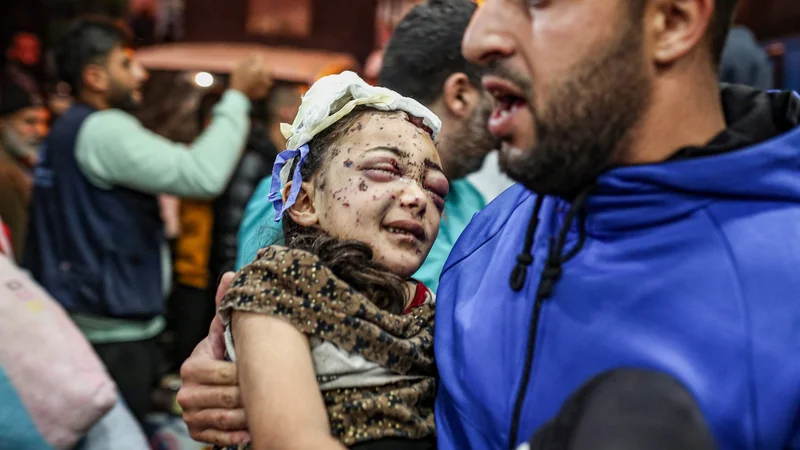 Fotografija: Ranjene Palestince evakuirajo iz indonezijske bolnišnice na severu Gaze. Izrael medtem nadaljuje napade v Gazi. V nočnem zračnem napadu na begunsko taborišče Nuseirat v osrednji Gazi je bilo po poročanju Al Džazire ubitih najmanj 20 ljudi, med njimi tudi ženske in otroci. Več ljudi je ranjenih, nekateri so v kritičnem stanju. Foto: Afp