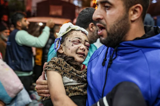 Ranjene Palestince evakuirajo iz indonezijske bolnišnice na severu Gaze. Izrael medtem nadaljuje napade v Gazi. V nočnem zračnem napadu na begunsko taborišče Nuseirat v osrednji Gazi je bilo po poročanju Al Džazire ubitih najmanj 20 ljudi, med njimi tudi ženske in otroci. Več ljudi je ranjenih, nekateri so v kritičnem stanju. Foto: Afp