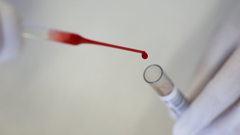 Fotografija: Preiskava kazalnika NT-proBNP je povsem neboleča, saj je zanjo potrebna le kapljica krvi iz prsta. FOTO: Michaela Rehle/Reuters