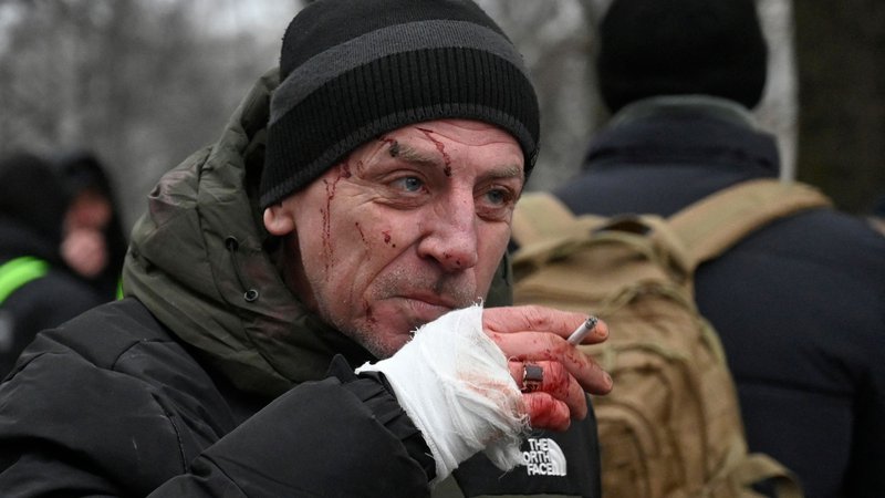 Fotografija: Ranjen moški kadi, potem ko je bila po raketnem napadu v Kijevu poškodovana stanovanjska stavba. Foto: Sergej Čuzavkov/Afp