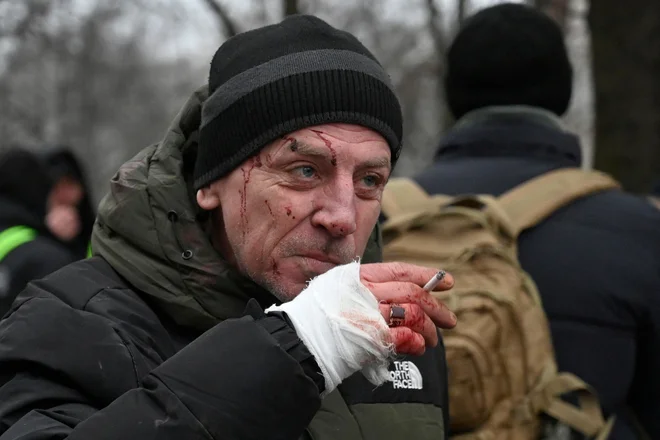 Ranjen moški kadi, potem ko je bila po raketnem napadu v Kijevu poškodovana stanovanjska stavba. Foto: Sergej Čuzavkov/Afp