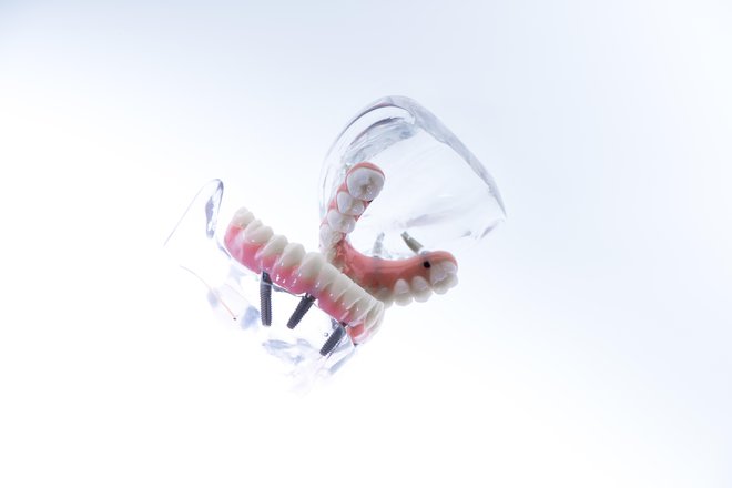 Klinika Ortoimplant Dental Spa uporablja vrhunske implantološke metode. FOTO: Ortoimplant Dental Spa