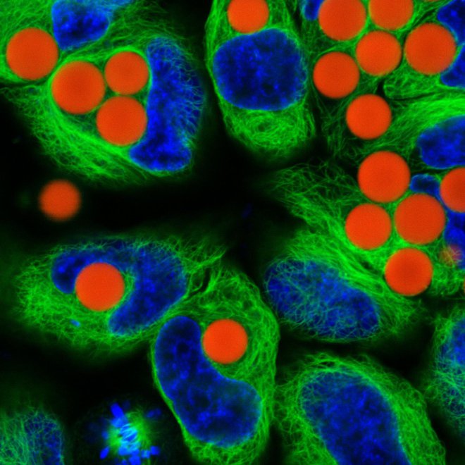Laserji (rdeče kroglice) v celicah (modro so celična jedra). FOTO: Ana Krišelj in Rok Podlipec

 