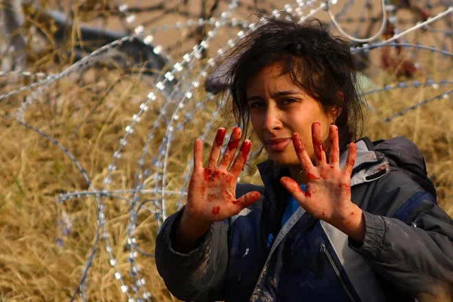 Migrantka iz Hondurasa Anadely Caballero kaže poškodovane roke po poskusu prečkanja žičnate ograje nedaleč od Ciudad Juareza, ki je postavljena, da bi migrantom preprečila prehod v Združene države Amerike. Foto: Jose Luis Gonzalez/Reuters
