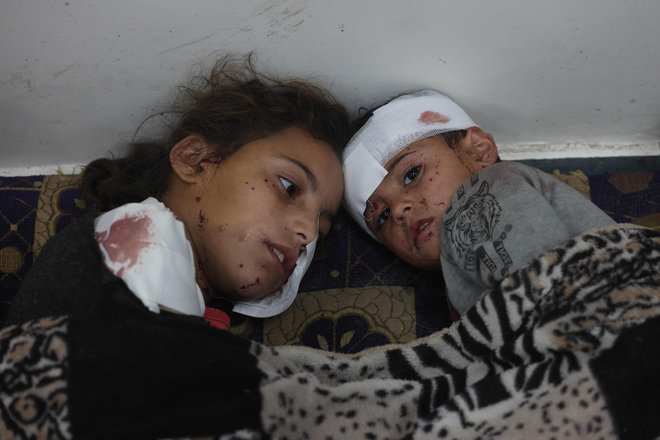 Ranjena palestinska deklica z bratcem. FOTO: Mohammed Abed/AFP