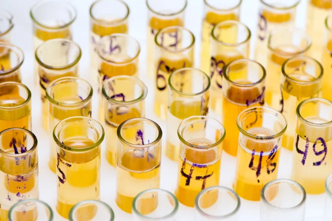 V letih 50. odtenkov rumene postajamo čedalje pogosteje prepuščeni sami sebi. FOTO: Shutterstock