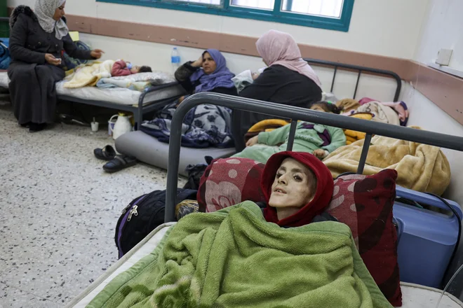 Desetletni palestinski deček Yazan al-Kafarneh, razseljen iz Beit Hanuna, ki zaradi podhranjenosti ležal na bolniški postelji na kliniki Al-Awda v Rafi na jugu Gaze. Yazan je umrl 4. marca 2024 zaradi hude podhranjenosti in nezadostne zdravstvene oskrbe. Ob pomanjkanju potrebnih zdravil in hudi podhranjenosti se življenjske razmere na obleganem palestinskem ozemlju iz dneva v dan slabšajo. Foto: Afp