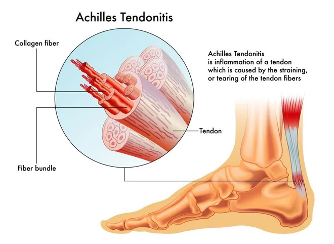 FOTO: Medicofit