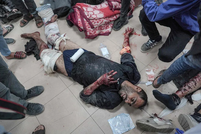 Palestinec, ranjen v izraelskem bombardiranju, čaka na zdravljenje v bolnišnici mučencev Al-Aksa v Deir el-Balahu v osrednjem delu Gaze. Izrael nadaljuje z napadi na mesto Rafa na jugu Gaze, kjer je zatočišče našlo več kot milijon Palestincev, mesto Al Nusejrat v osrednjem delu Gaze, kjer je bilo uničenih najmanj pet hiš, in območje Al Džabalija na severu. Foto: Afp