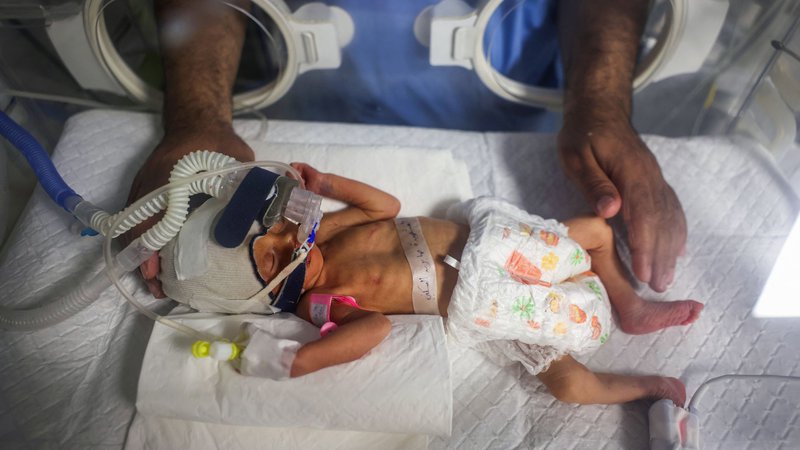 Fotografija: V bolnišnici v Rafi na jugu Gaze zdravnik skrbi za Sabreen al-Ruh al-Sheikh, palestinsko dojenčico, ki se je rodila predčasno s carskim rezom nekaj minut pred smrtjo njene matere, ki je bila hudo ranjena v izraelskem zračnem napadu. Foto: Afp